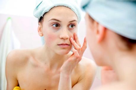 5 rimedi naturali contro borse e occhiaie, super efficaci! 5 rimedi naturali contro borse e occhiaie, super efficaci!