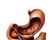 Ernia iatale: nozioni base