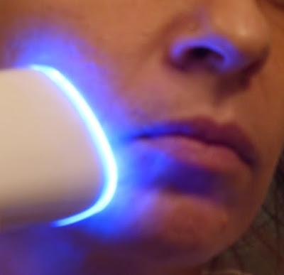 Pelle bella e sana con Tanda Clear a LED Pelle bella e sana con Tanda Clear a LED
