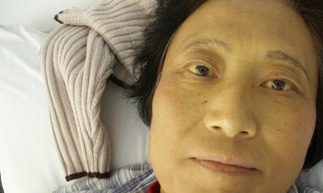 Rimedi della Nonna contro l’ittero Rimedi della Nonna contro l’ittero