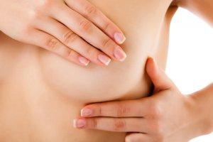 Cancro al seno in fase iniziale: la chemioterapia non serve nel 70% dei casi cancro seno
