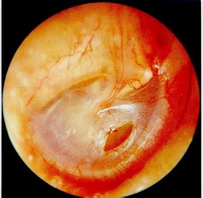 La Malassezia(Malassezia Pachydermatis) causa di dermatiti e otiti nel cane e nel gatto :come si combatte?