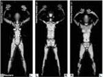 body-scanner