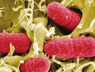 Il batterio killer dell'Escherichia coli proviene da germogli di soia tedeschi, mangiati crudi.