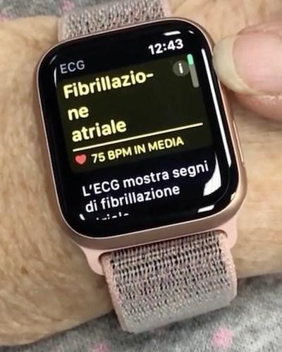 Apple Watch 4: ecco come far funzionare l’ECG in italiano. (aggiornato) Apple Watch 4: ecco come far funzionare l’ECG in italiano. (aggiornato)