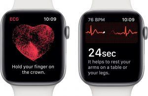 Apple Watch fa l’elettrocardiogramma in 30 secondi apple watch
