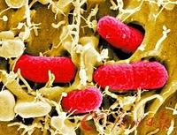 Enterohemorrhagic Escherichia coli: ritornano colpevoli i germogli crudi?