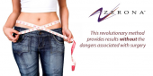 Medicina estetica: Zerona laser