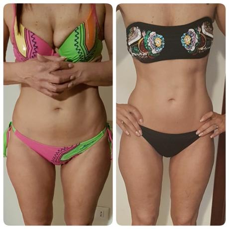 WORLD OF BEAUTY: CELLULITE DI TIPO MOLLE O FLACCIDO WORLD OF BEAUTY: CELLULITE DI TIPO MOLLE O FLACCIDO