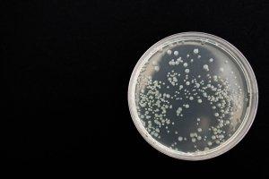 Infezioni resistenti: in viaggio le contraggono 500mila italiani! batteri