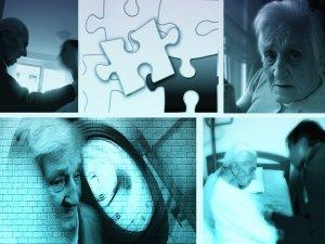 Alzheimer: dipende dai geni o dallo stile vita? demenza