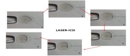 fecondazione in vitro