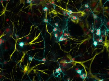 Cnr. Identificato il meccanismo molecolare all’origine di alcune forme di disabilità intellettive Cnr. Identificato il meccanismo molecolare all’origine di alcune forme di disabilità intellettive