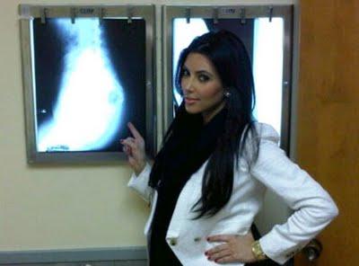 Kim Kardashian X-Rays her Butt : IT'S REAL !!