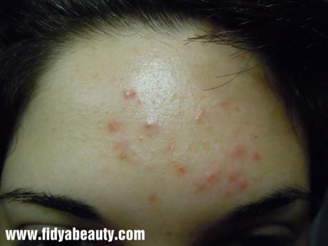 Liz Earle: Skin Repair Moisturiser, una brutta esperienza…