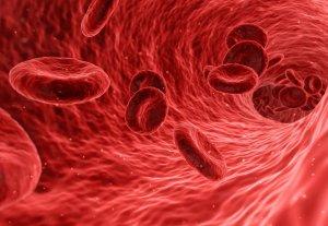 Colesterolo alto: i soggetti più a rischio di infarto e ictus colesterolo alto