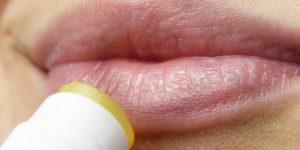 Labbra screpolate in inverno ecco come curare le labbra secche Le labbra screpolate o secche