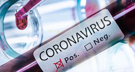 Lo strano mistero del Coronavirus che sembra non esistere a Roma Lo strano mistero del Coronavirus che sembra non esistere a Roma