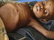 CARESTIA SOMALIA. PERICOLO MILIONI MORTI, BAMBINI, INTERVERRà NELL’IMMEDIATO