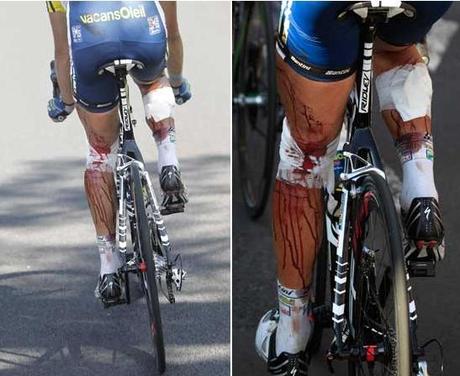 Tour de France 2011 : Hoogerland e il filo spinato (foto CHOC!)
