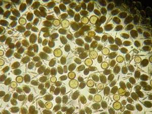 E' l'alga Ostreopsis Ovata la probabile colpevole