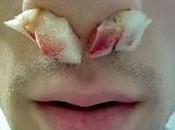 Pare metterà TAMPONE