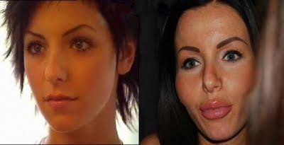 Le t.A.T.u. Una esce con un singolo l'altra si riempie di botox!