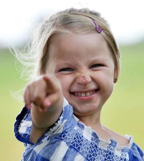 LA BAMBINA CON IL NASO DA CLOWN ORA SORRIDE SERENA...