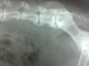 Spondilartrosi vertebrale deformante, osteofitosi cane