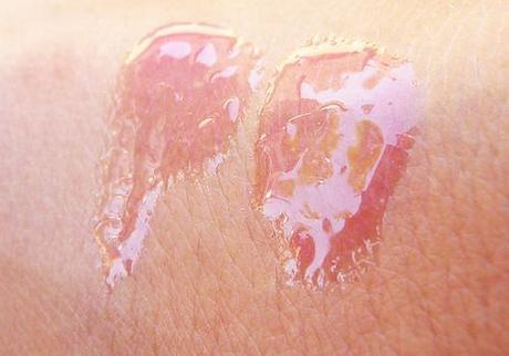 H&M; Lipgloss in Azalea Glow H&M; Lipgloss in Azalea Glow
