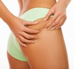 Addio alla cellulite con una dieta specifica