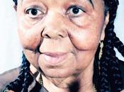 Cesaria evora ricoverata parigi ictus