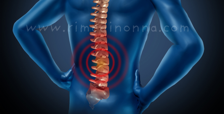 Rimedi naturali per il Mal di Schiena