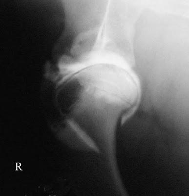 L’Osteocondrite Dissecante (OCD) della Spalla nel Cane.