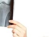 Osteoporosi: soffre delle italiane