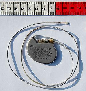 Wilson Greatbatch è morto: inventò il pacemaker