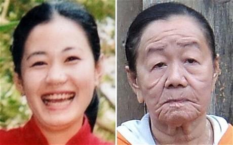 (L-R) Nguyen Thi Phuong, aged 21 and how she looks now, aged 26, after having suffered an allergic reaction to seafood