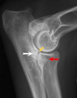 ARTROSI DEL GOMITO NEL CANE :UNA TECNICA CHIRURGICA PER ALLEVIARE IL DOLORE