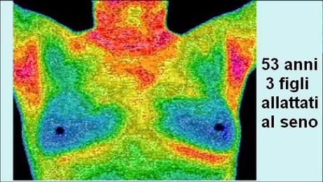 DONNE: TUMORE AL SENO E DENTI DEVITALIZZATI - (dal Dott. Lorenzo Acerra Comi.L.Va.)