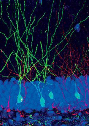 Neuroplasticità