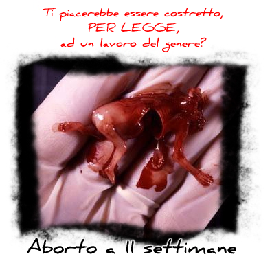 Libertà di abortire - Libertà di obiettare