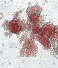 Nuovi promettenti impieghi per le cellule staminali del cordone ombelicale