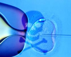 I nati da fecondazione in vitro hanno più probabilità di avere malattie genetiche