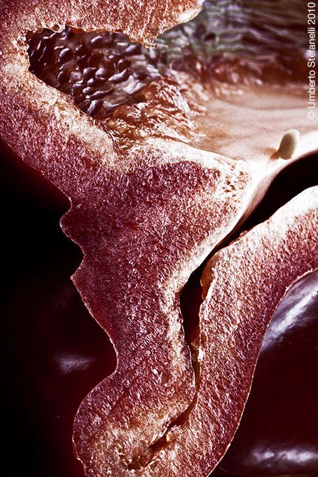 06_08_10_frattura_processo_spinoso_c7_197_pg