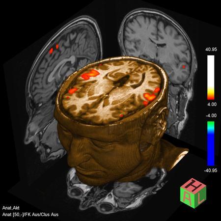 La Neurologia Funzionale.