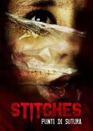 Stitches