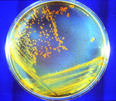 Deinococcus radiodurans radiazioni