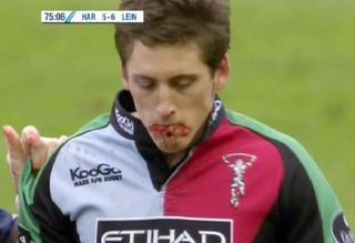 Il Bloodgate si è chiuso, una volta per tutte