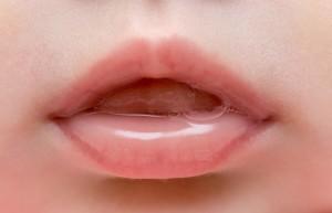 Carie: il test della saliva