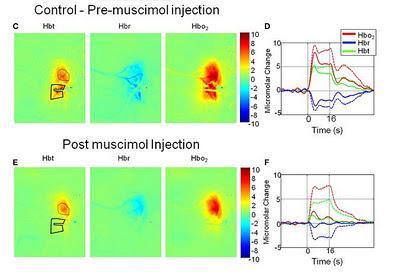 Cosa registra la risonanza magnetica funzionale